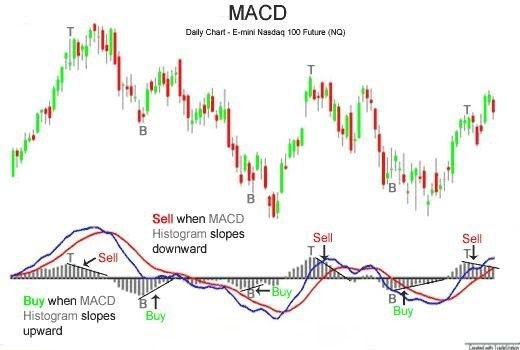 MACD